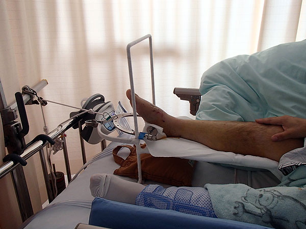 芋にぃちゃんさんの足